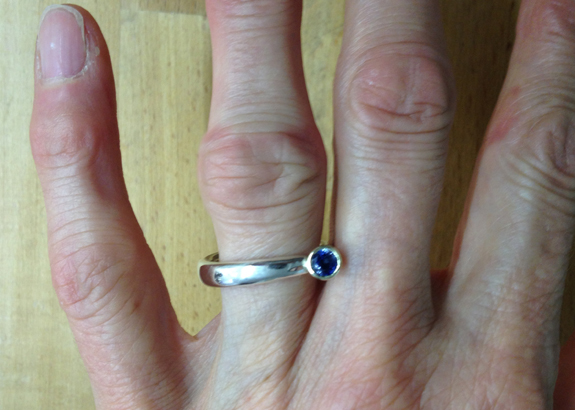 veränderte Fingerknöchel